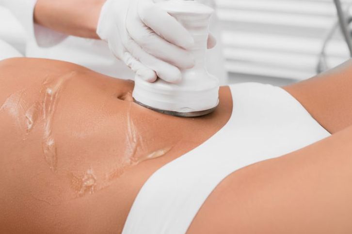 Usługa
